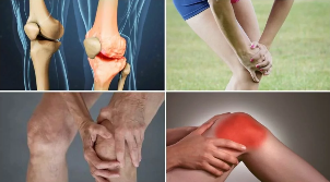 the symptoms of arthrosis