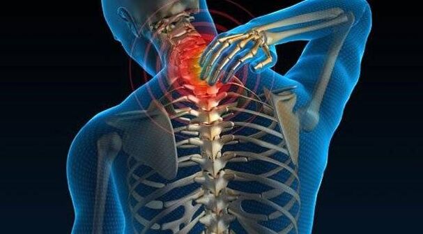 Osteocondritis of the spine